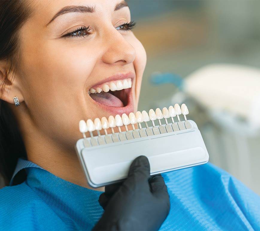 Porcelain veneers